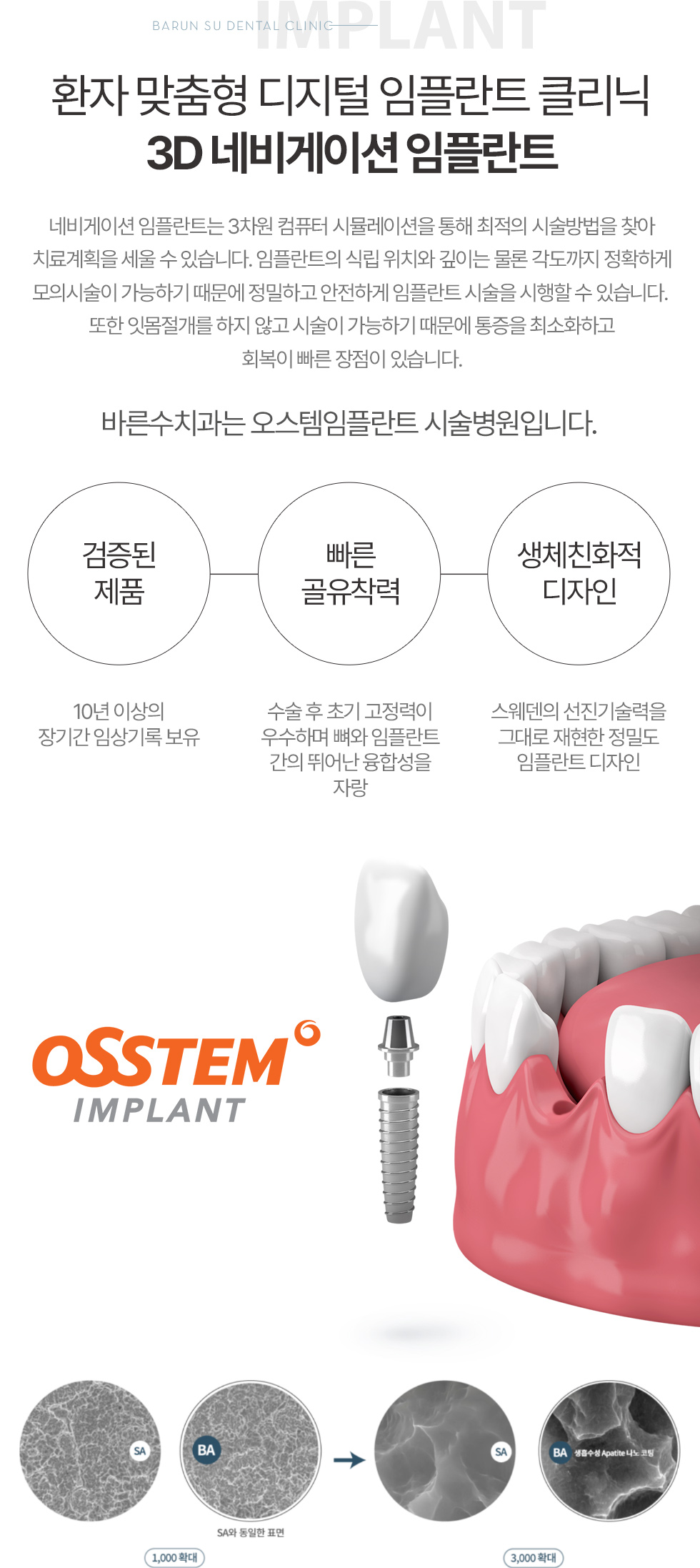 진료환자 맞춤형 디지털 임플란트 클리닉. 3D 네비게이션 임플란트과목