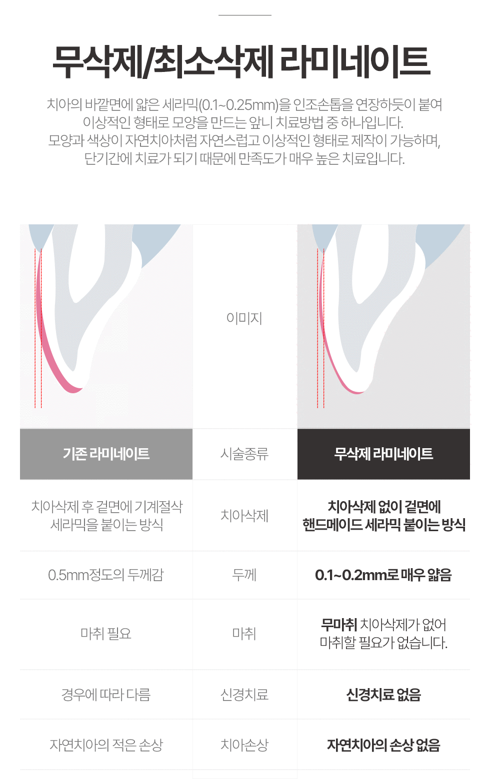 무삭제/최소삭제 라미네이트