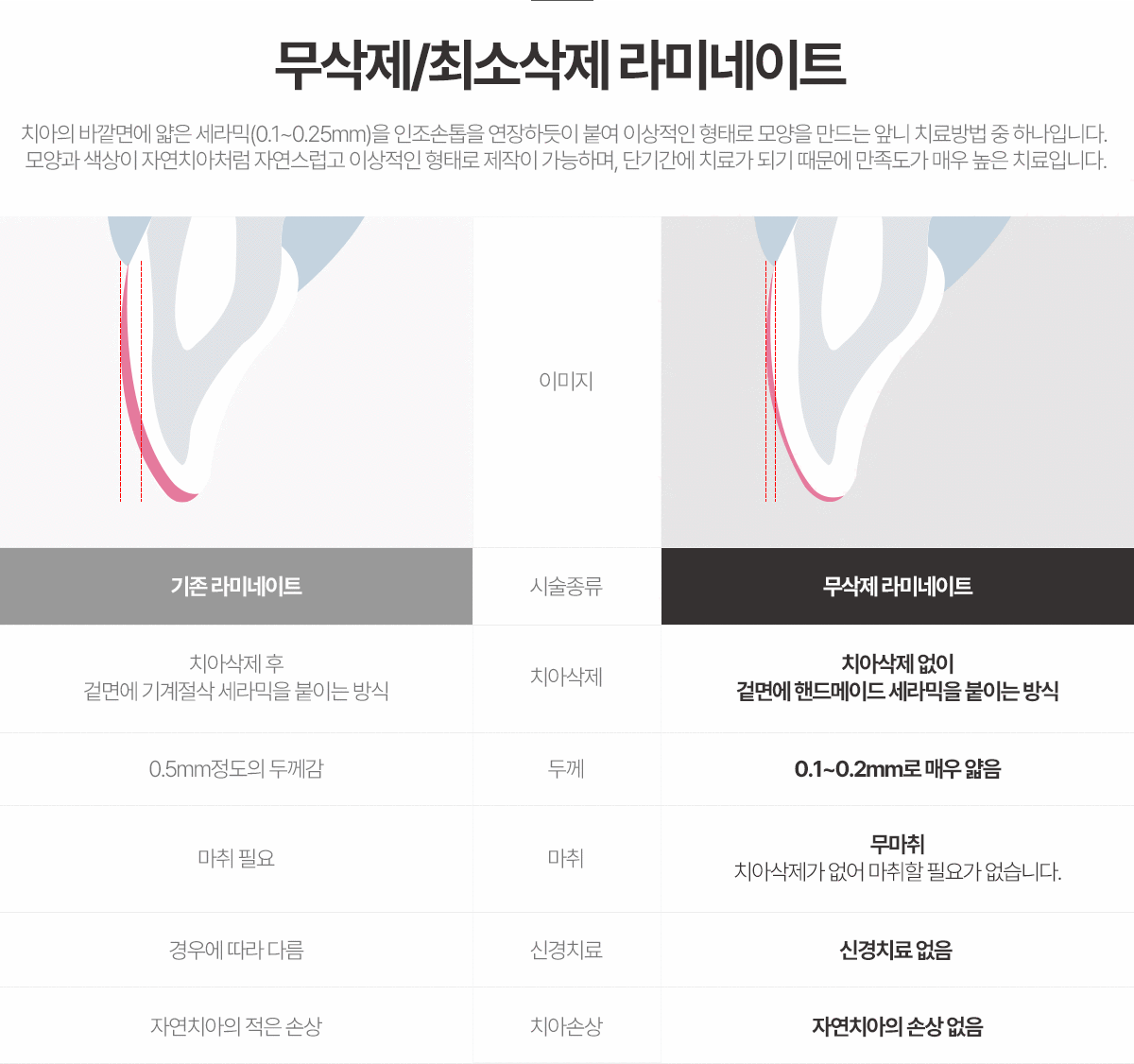 무삭제/최소삭제 라미네이트